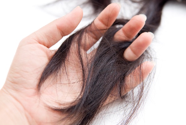 علاج تساقط الشعر الدهني للنساء