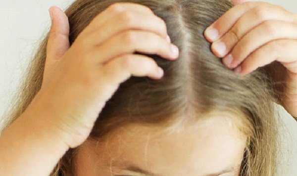 علاج تساقط الشعر عند الاطفال بالاعشاب